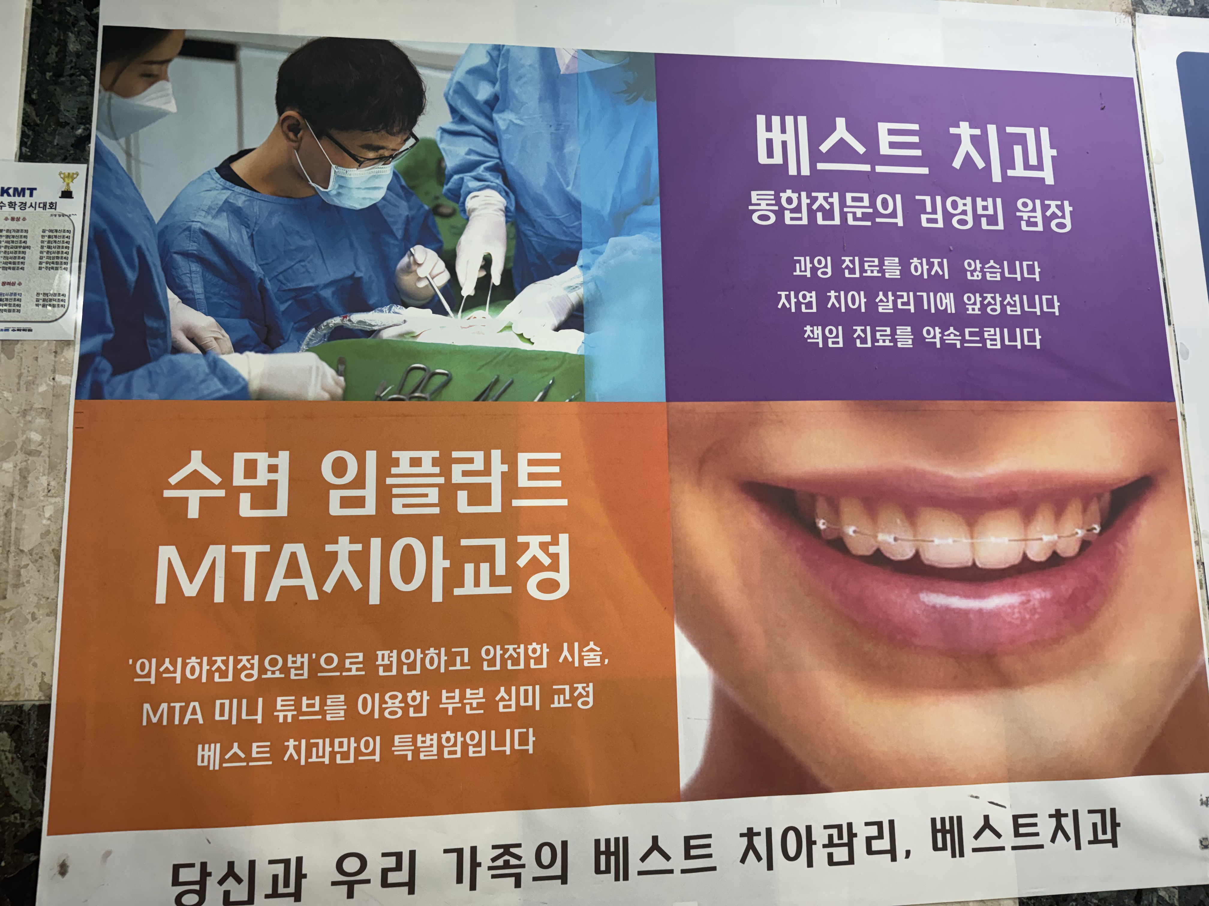 MTA 치아교정